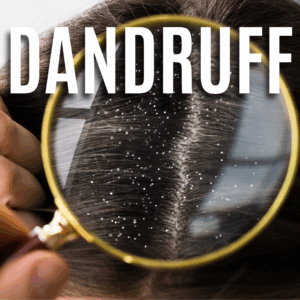 Dandruff App