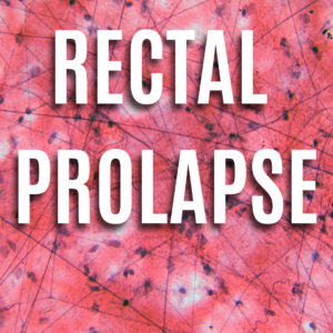 Rectal Prolapse App