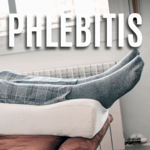 Phlebitis App