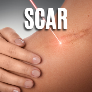 Scar App