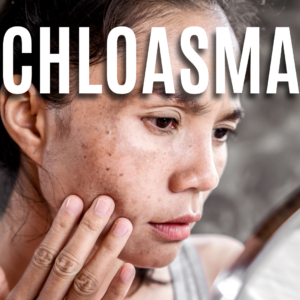 Chloasma App