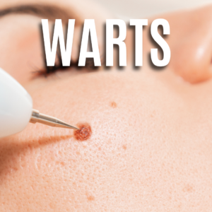 Warts App