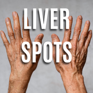 Liver Spots App