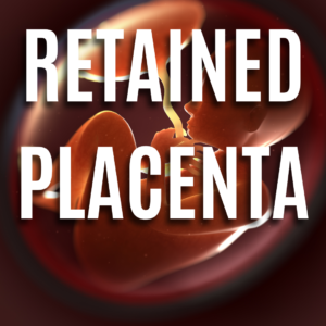 Retained Placenta App