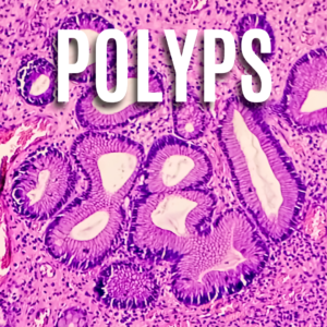 Polyps App