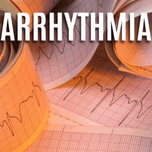 Arrhythmia App