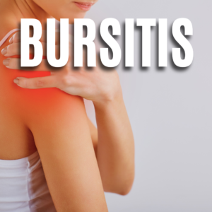 Bursitis App