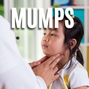 Mumps App