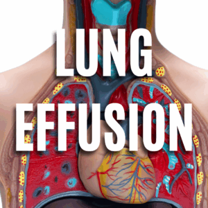 Lung Effusion App