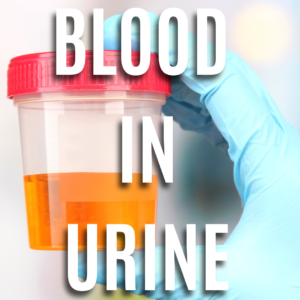 Blood In The Urine App