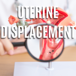 Uterine Displacement App