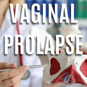 Vaginal Prolapse App