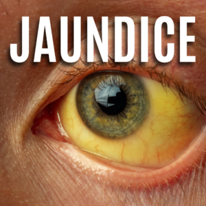 Jaundice App