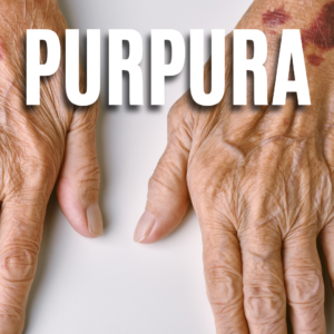 Purpura App
