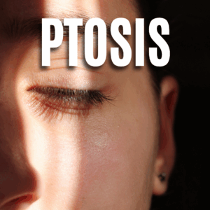 Ptosis App