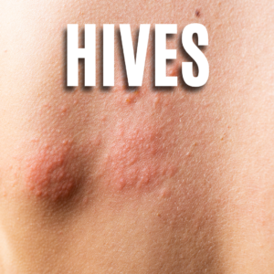 Hives App