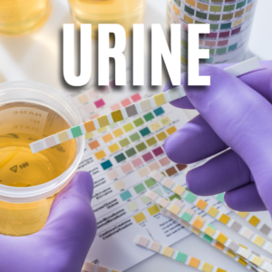 Urine App