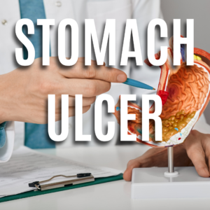 Stomach Ulcer App