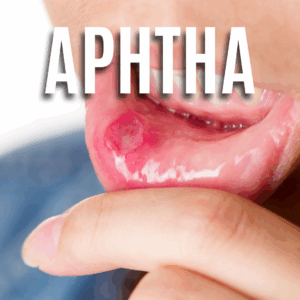 Aphtha App
