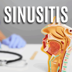 Sinusitis App