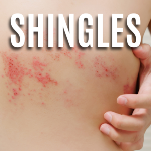 Shingles App
