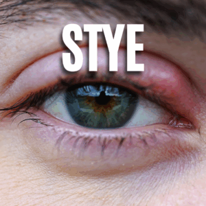 Stye App