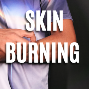 Skin  Burning App