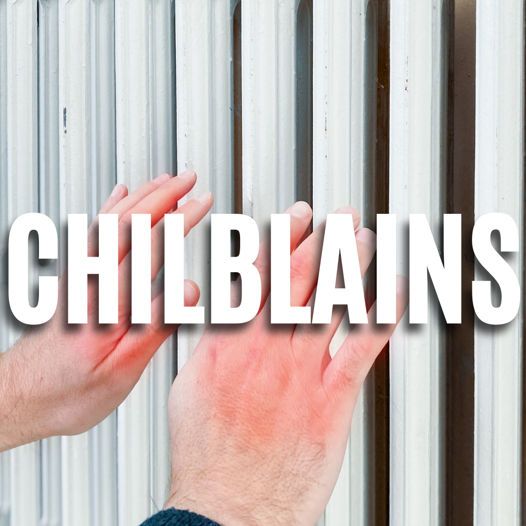 Chilblains