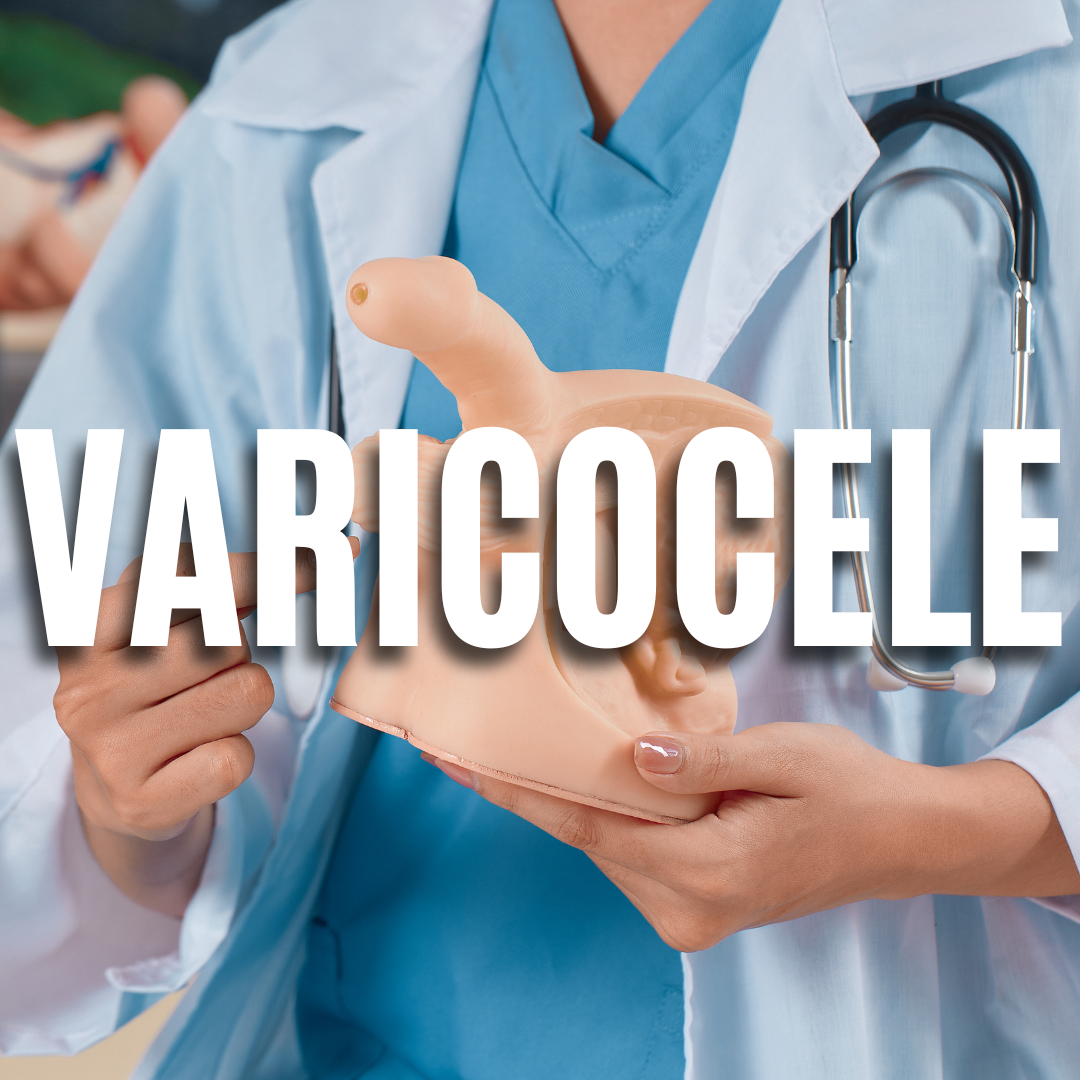 Varicocele