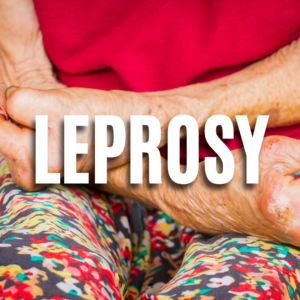Leprosy