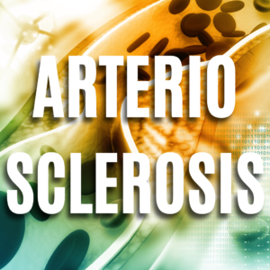 Arteriosclerosis