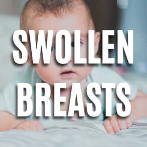 Breast Swelling Baby  QUIZ