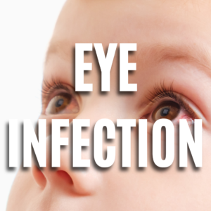 Eye Infection Baby  QUIZ