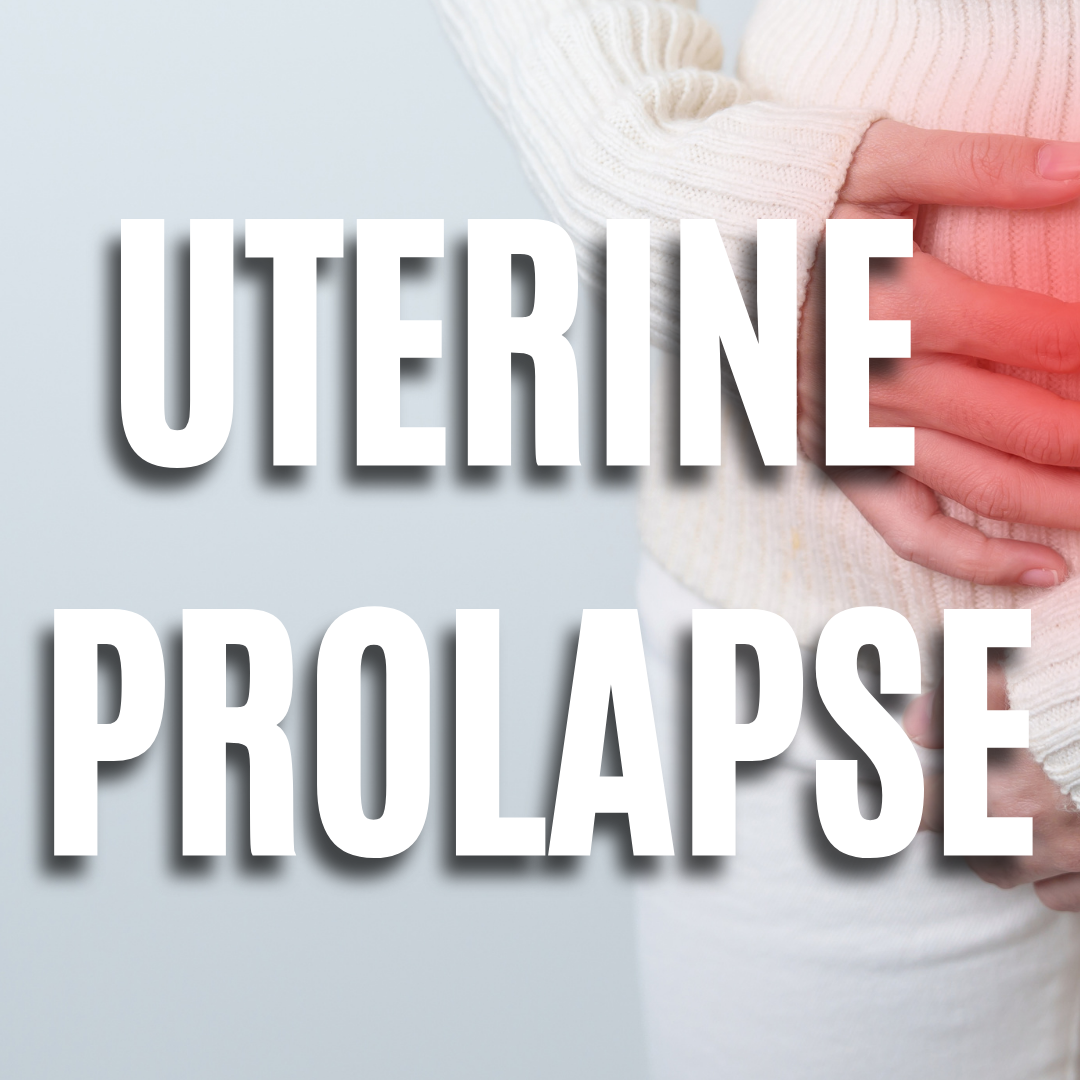 Uterine Prolapse QUIZ