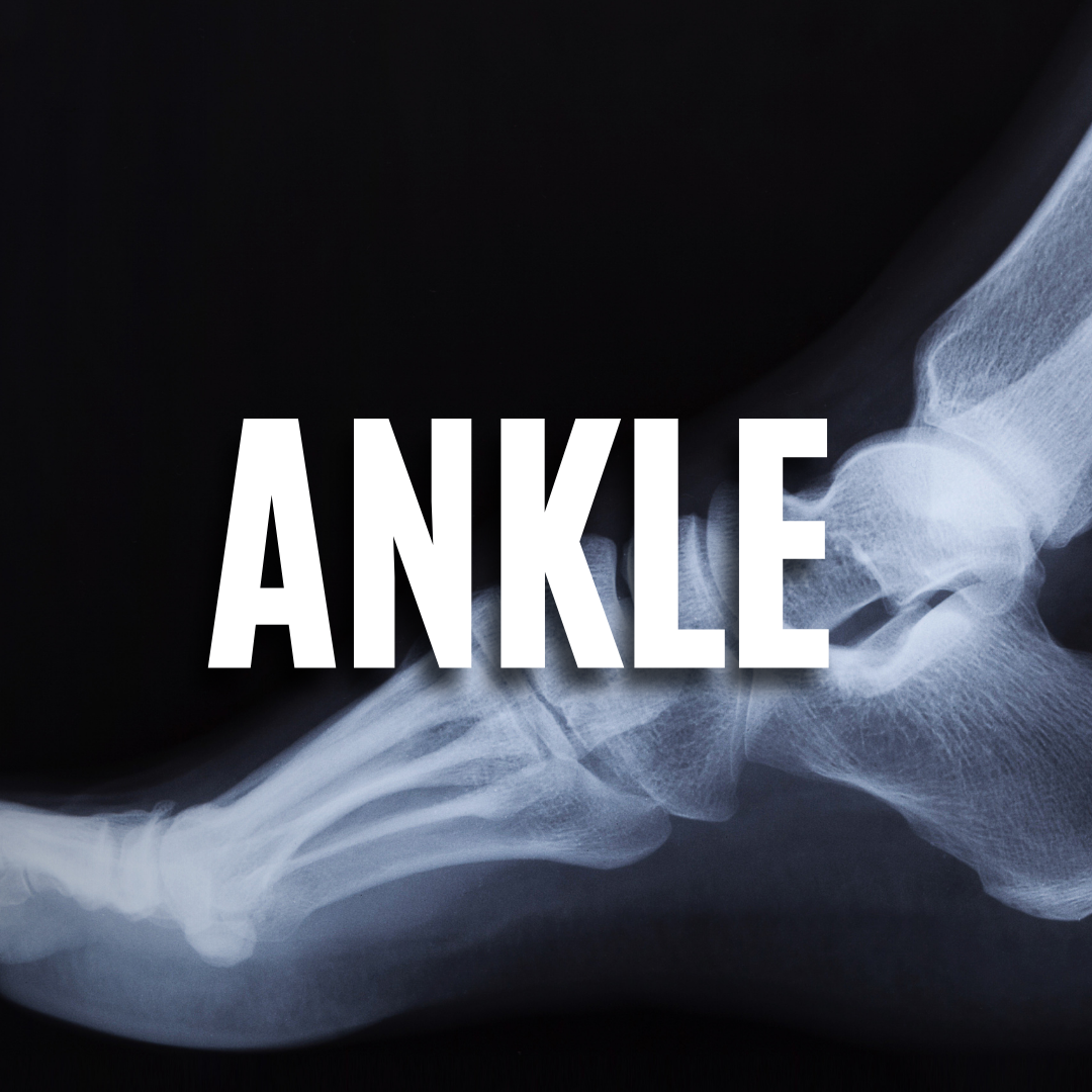 Ankle QUIZ